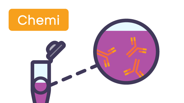 Chemiluminescence: Primary Antibody Incubation