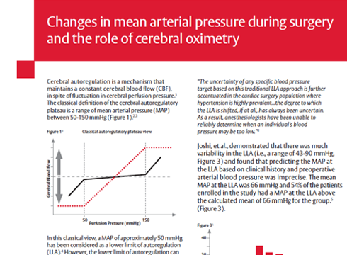 ForeSight whitepaper: Changes in mean arterial pressure