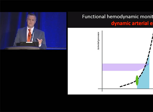 Differentiating the Cause of Hypotension by Manuel Ignacio Monge (ASA 2017)