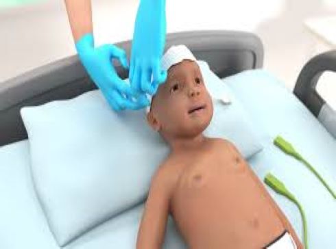 Pediatric ForeSight Elite Tissue Oximetry sensor setup on HemoSphere monitor