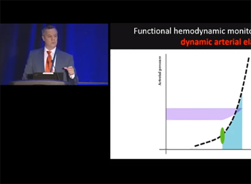 Differentiating the Cause of Hypotension by M. Ignaciao Monge (ASA 2017)