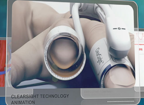 ClearSight system overview