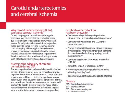 ForeSight whitepaper: Carotid endarterectomies and cerebral ischemia