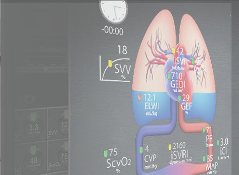 Volume Administration Game