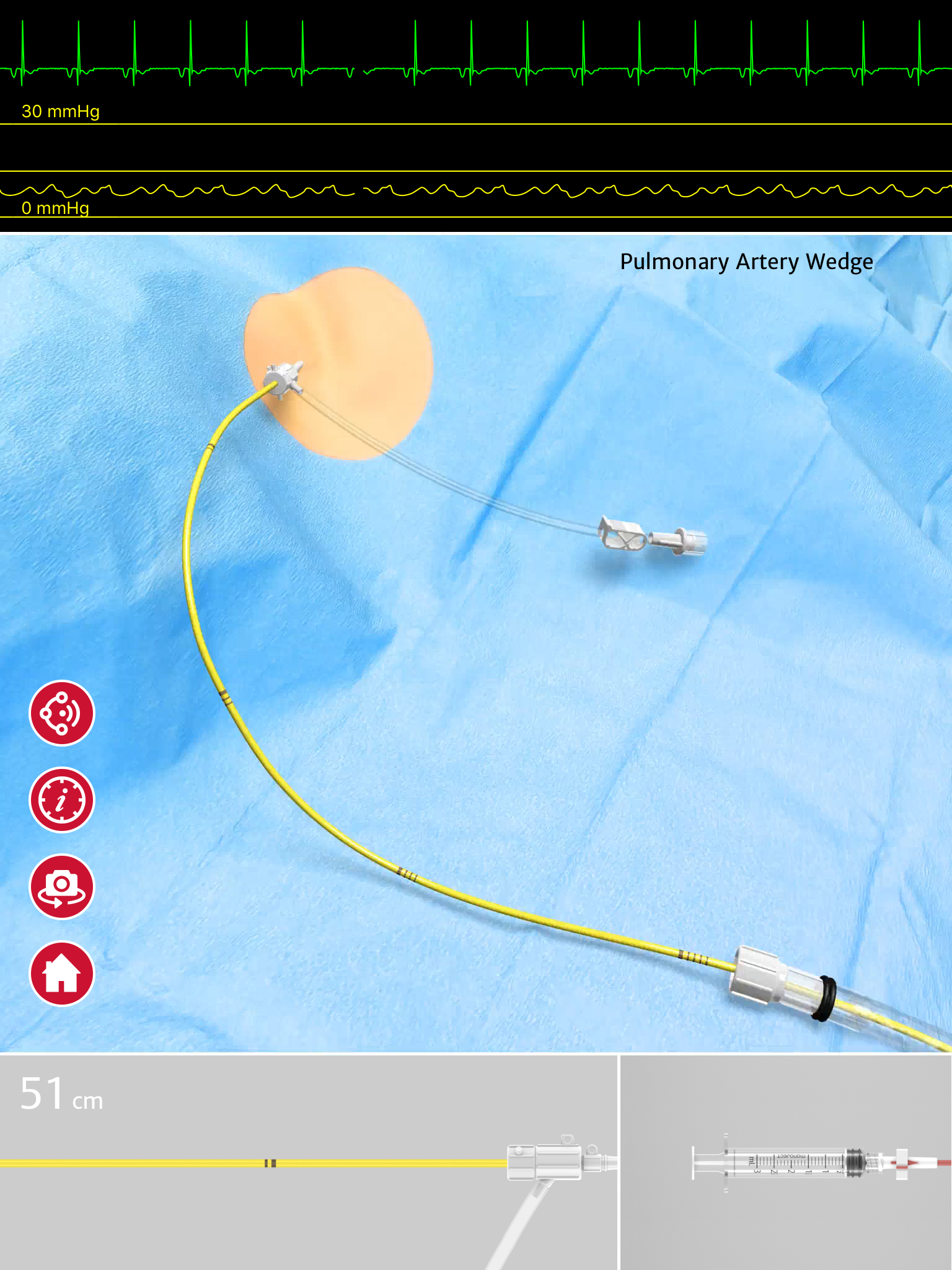 Swan-Ganz™ Simulator iPad App