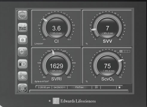 FloTrac sensor on EV1000 Clinical Platform eLearning
